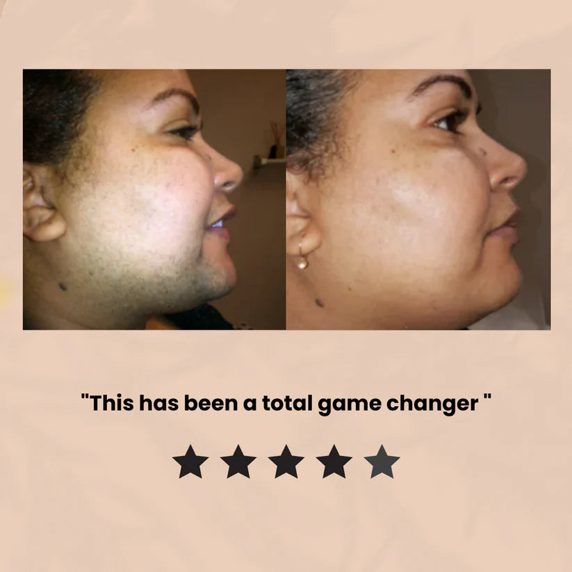 2-Step Hair Removal Kit