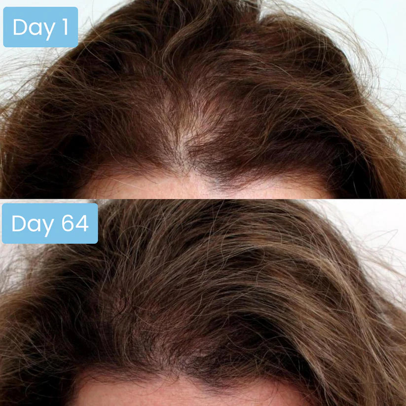 Scalpy Hair Serum
