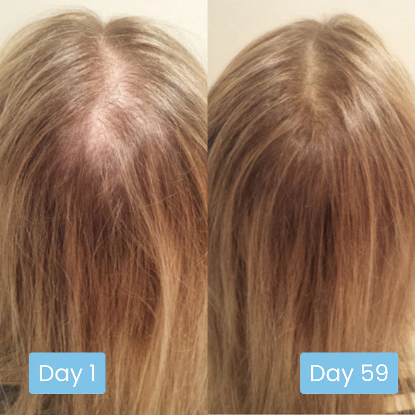 Scalpy Hair Serum