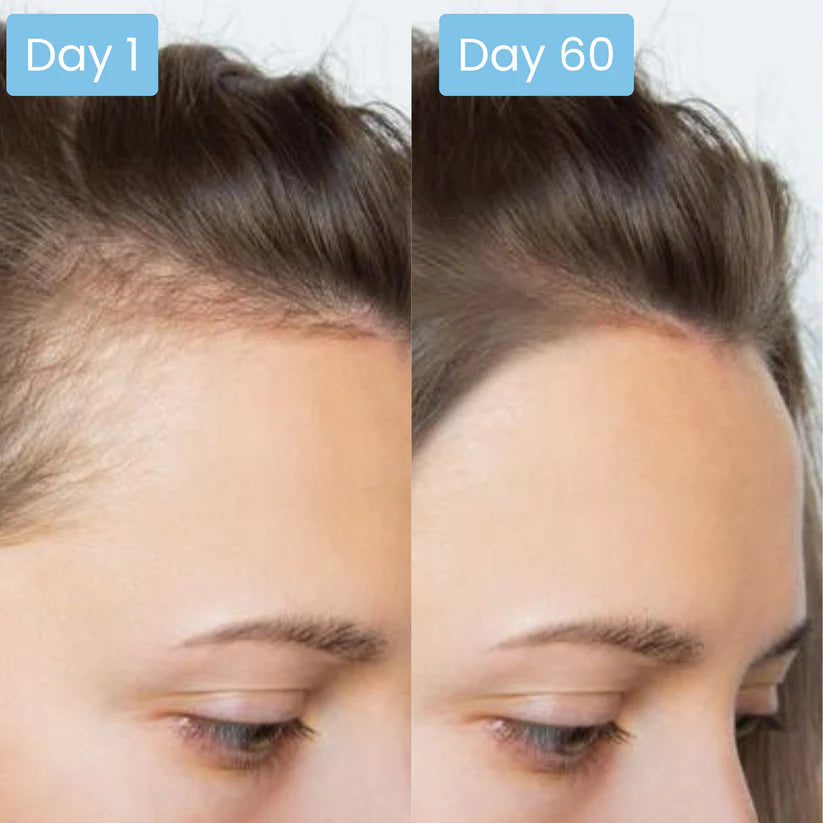 Scalpy Hair Serum