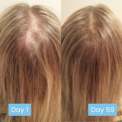 Scalpy Hair Serum