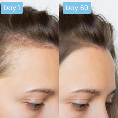 Scalpy Hair Serum